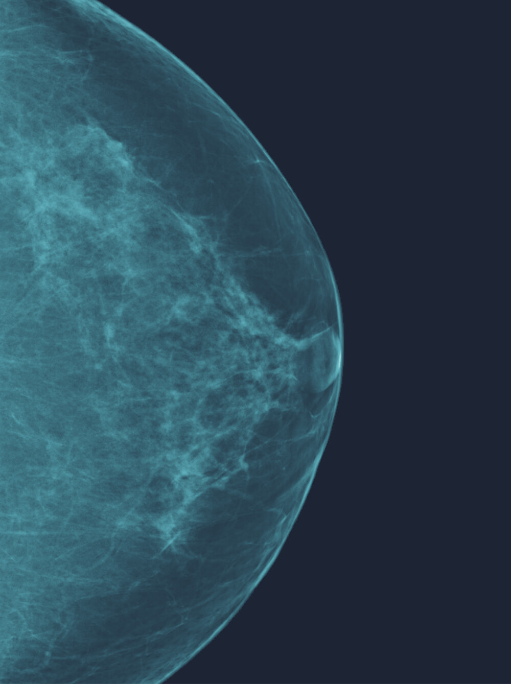 Detection and diagnosis